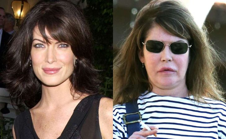 Lara Flynn Boyle Plastic Surgery - All the Facts Here!
